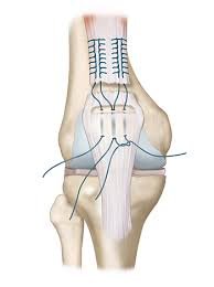Soft Tissue Orthopaedic Procedures